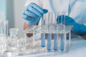 جبران هزینه آزمایش با بیمه تکمیلی